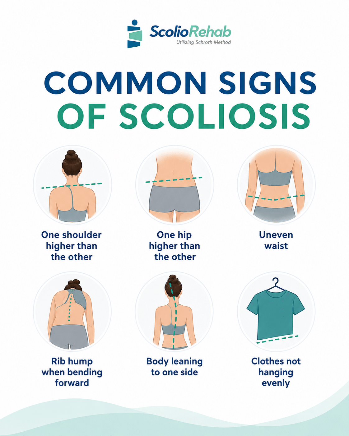 Common signs of scoliosis