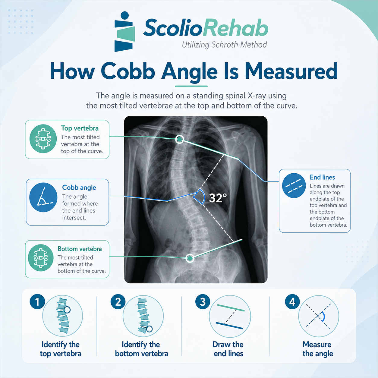 how is cobb angle is measured
