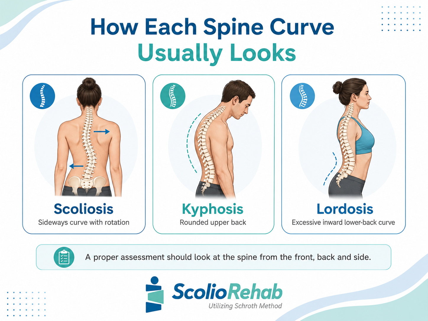scoliosis kyphosis lordosis are