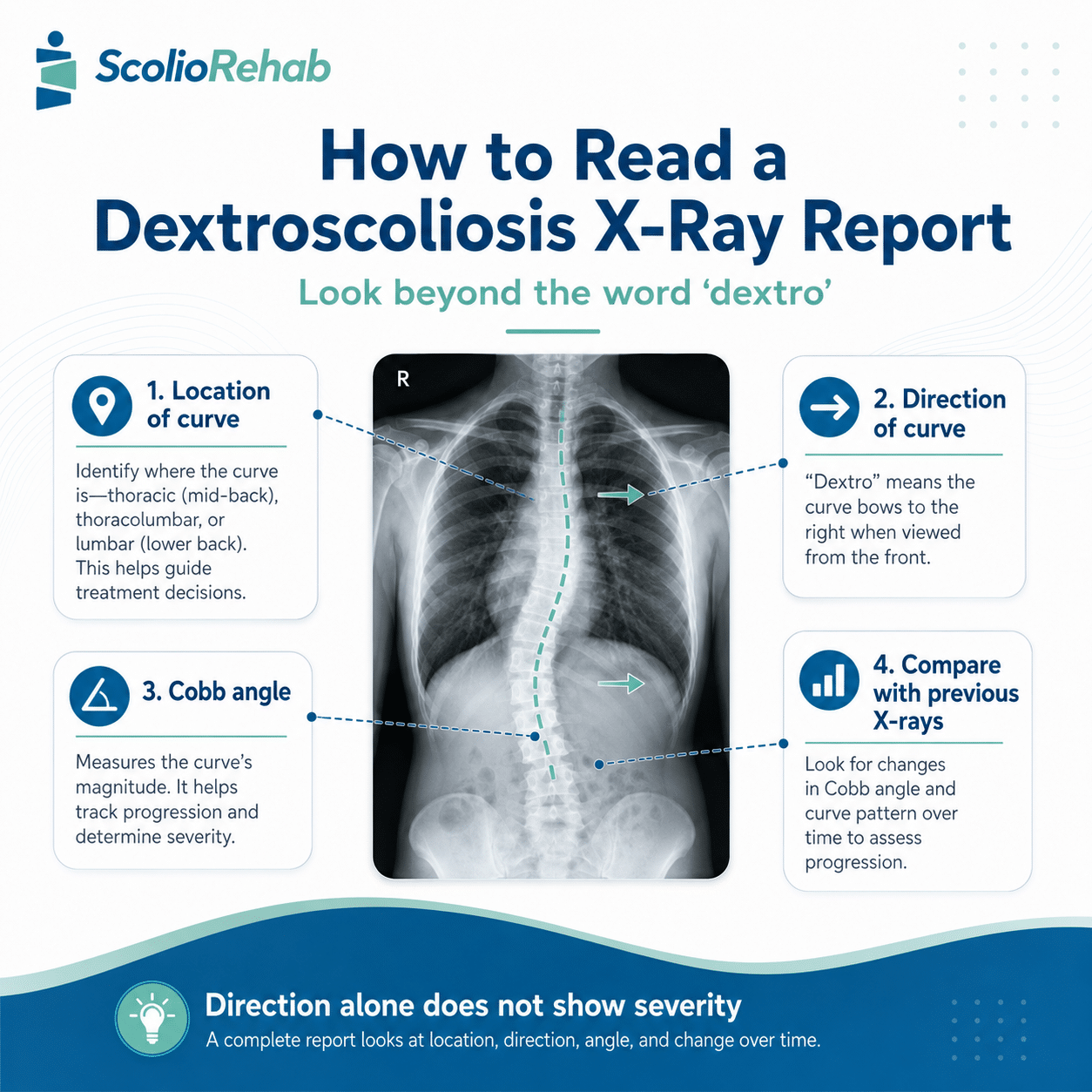 how to read a dextroscoliosis x ray report