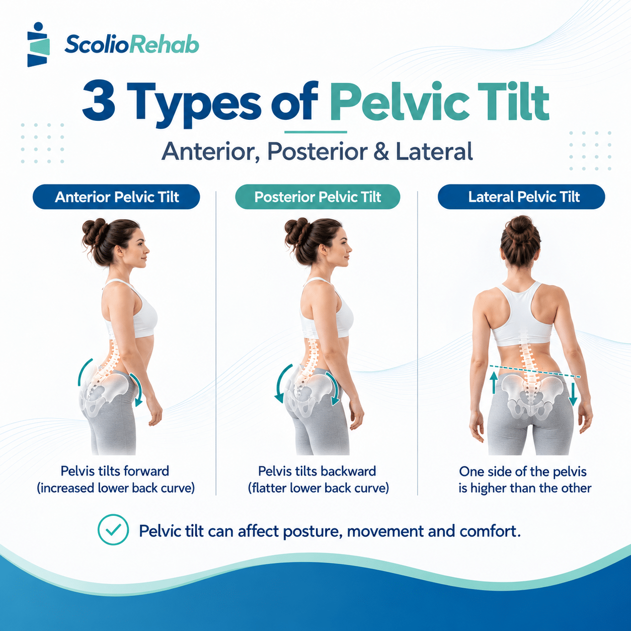 types of pelvic tilt